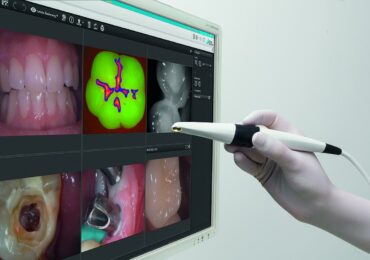Diagnosi pecoce carie Vistacam Durr