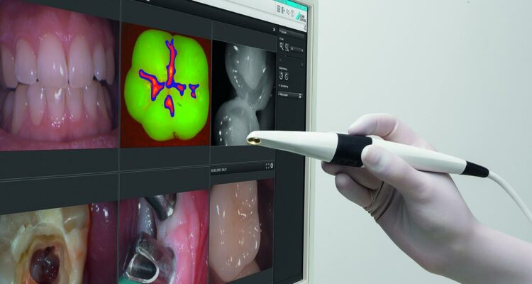 Diagnosi pecoce carie Vistacam Durr