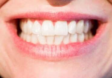 sorriso bellissimo