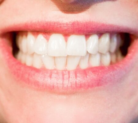 sorriso bellissimo