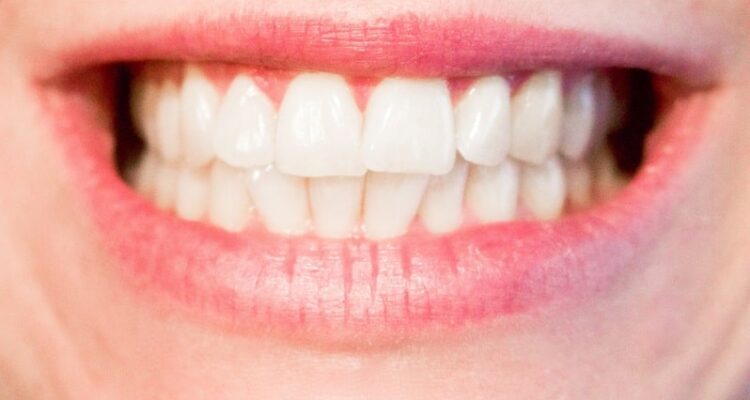 sorriso bellissimo